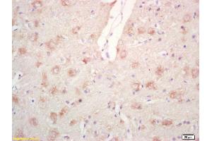Formalin-fixed and paraffin embedded rat brain labeled with Rabbit Anti Phospho-PPIG (Ser376) Polyclonal Antibody, Unconjugated (ABIN746678) at 1:200 followed by conjugation to the secondary antibody and DAB staining (PPIG antibody  (pSer376))