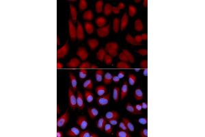 Immunofluorescence analysis of U2OS cells using TAP2 antibody (ABIN5970782). (TAP2 antibody)