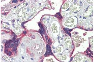 Human Placenta: Formalin-Fixed, Paraffin-Embedded (FFPE) (Desmocollin 3 antibody  (AA 822-850))