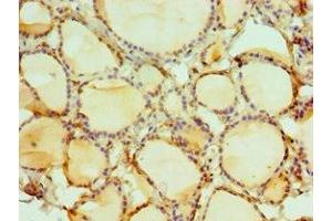 Immunohistochemistry of paraffin-embedded human thyroid tissue using ABIN7149566 at dilution of 1:100