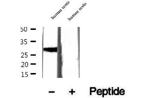 Western blot analysis of extracts of human testis tissue, using CRISP2 antibody. (CRISP2 antibody  (Internal Region))