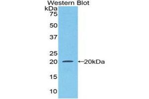 Western Blotting (WB) image for anti-Colony Stimulating Factor 1 Receptor (CSF1R) (AA 734-900) antibody (ABIN1174698)