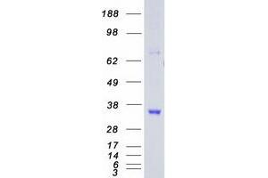 Validation with Western Blot (CDK5 Protein (Myc-DYKDDDDK Tag))
