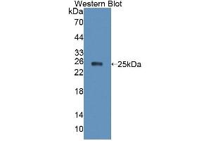 Figure. (XPO5 antibody  (AA 2-180))