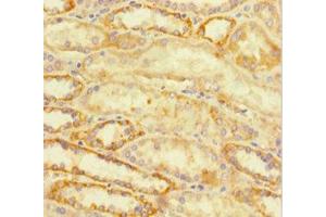 Immunohistochemistry of paraffin-embedded human kidney tissue using ABIN7172767 at dilution of 1:100 (ATRX antibody  (AA 2161-2443))