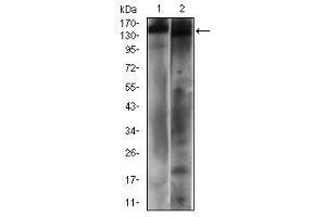 Western blot analysis using PTPRC mouse mAb against Hela (1) and A431 (2) cell lysate.