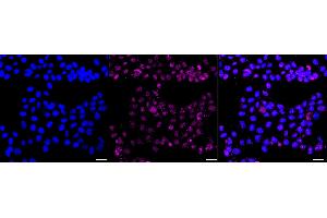 Immunocytochemical staining of HAP-1 cells with GST3 / GSTP1 antibody (ABIN7798758), 1:1,000). (Recombinant GSTP1 antibody)