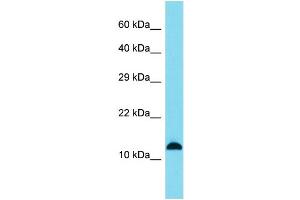 Host: Rabbit Target Name: SPANXB1 Sample Type: A549 Whole Cell lysates Antibody Dilution: 1. (SPANXB1 antibody  (Middle Region))