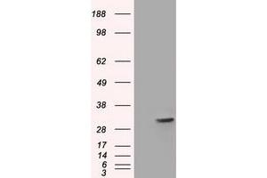 Western Blotting (WB) image for anti-Four and A Half LIM Domains 1 (FHL1) antibody (ABIN1500976) (FHL1 antibody)