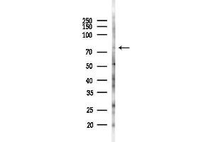 anti-Choroideremia (Rab Escort Protein 1) (CHM) antibody