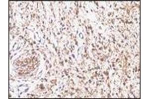 Immunohistochemistry (IHC) image for anti-S-100 (C-Term) antibody (ABIN870447) (S-100 antibody  (C-Term))