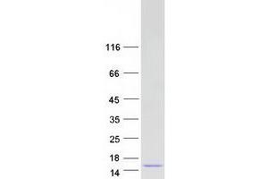 Catenin, beta Interacting Protein 1 (CTNNBIP1) (Transcript Variant 1) protein (Myc-DYKDDDDK Tag)