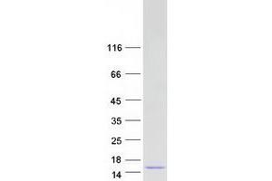 Validation with Western Blot (CTNNBIP1 Protein (Transcript Variant 1) (Myc-DYKDDDDK Tag))