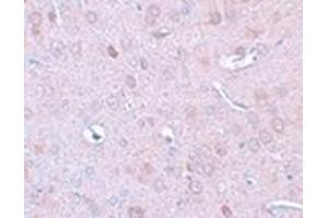 Immunohistochemistry of DLCK1 in rat brain tissue with DLCK1 antibody at 2. (DCLK1 antibody  (N-Term))