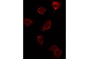 ABIN6276899 staining NIH-3T3 by IF/ICC. (Prosaposin antibody  (Internal Region))
