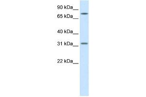 WB Suggested Anti-WNT8B Antibody Titration:  1.