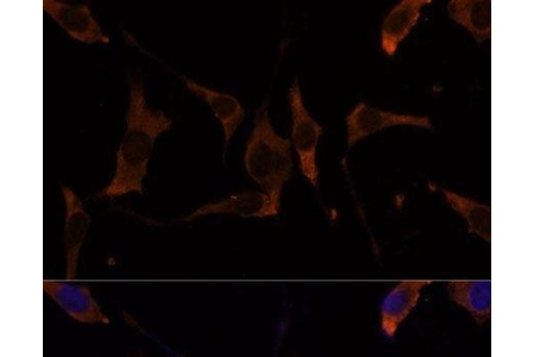 RPL7A antibody