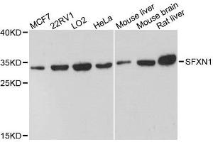 Western blot analysis of extracts of various cell lines, using SFXN1 antibody. (SFXN1 antibody  (AA 87-322))