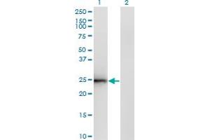 Western Blotting (WB) image for anti-Cell Death-Inducing DFFA-Like Effector B (CIDEB) (AA 3-110) antibody (ABIN565343)