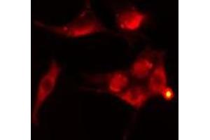 ABIN6276416 staining  Hela cells by IF/ICC. (TRAF2 antibody  (C-Term))