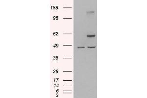 HEK293 overexpressing Human TRAF2 and probed with ABIN2560516 (mock transfection in first lane). (TRAF2 antibody  (C-Term))