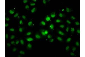 Immunofluorescence staining of Hela cells with ABIN7147693 at 1:100, counter-stained with DAPI. (INO8 (AA 1365-1495) antibody)