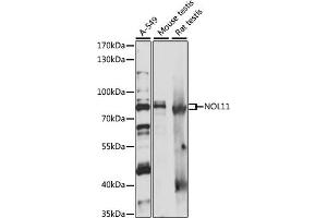 Western blot analysis of extracts of various cell lines, using NOL11 antibody (ABIN7269032) at 1:1000 dilution. (NOL11 antibody  (AA 300-600))