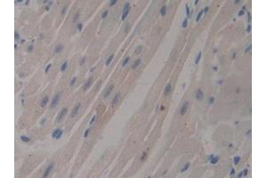 Immunohistochemistry (IHC) image for anti-Mucin 1 (MUC1) (AA 474-630) antibody (ABIN7442027)