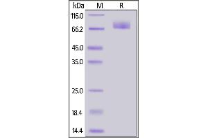 SARS-CoV-2 S2 protein, His Tag on  under reducing (R) condition.