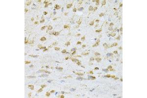 Immunohistochemistry of paraffin-embedded mouse brain using VAPB Antibody. (VAPB antibody)