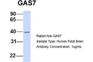 Host:  Rabbit  Target Name:  GAS7  Sample Type:  Human Fetal Brain  Antibody Dilution:  1. (GAS7 antibody  (N-Term))
