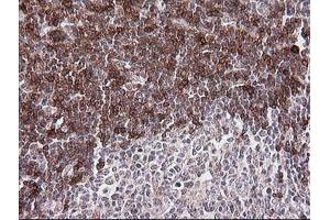 Immunohistochemistry (IHC) image for anti-T-cell surface glycoprotein CD1c (CD1C) antibody (ABIN2670658) (CD1c antibody)