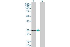 Western Blot analysis of NDUFS8 expression in transfected 293T cell line by NDUFS8 MaxPab polyclonal antibody. (NDUFS8 antibody  (AA 1-210))