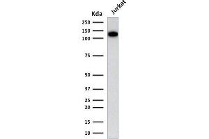 Western Blotting (WB) image for anti-Platelet/endothelial Cell Adhesion Molecule (PECAM1) antibody (ABIN6940282)
