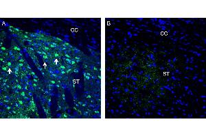 Expression of Neuronal Pentraxin 1 in rat striatum.