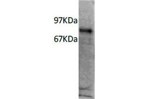 Western Blotting (WB) image for anti-Interleukin 7 Receptor (IL7R) antibody (ABIN6923149) (IL7R antibody)