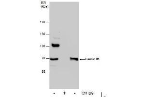 IP Image Immunoprecipitation of Lamin B1 protein from 293T whole cell extracts using 5 μg of Lamin B1 antibody, Western blot analysis was performed using Lamin B1 antibody, EasyBlot anti-Rabbit IgG  was used as a secondary reagent. (Lamin B1 antibody)