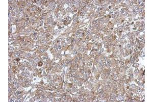 IHC-P Image Immunohistochemical analysis of paraffin-embedded Hela xenograft, using C18orf25, antibody at 1:500 dilution. (C18ORF25 antibody)