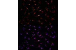 Immunofluorescence analysis of U-2 OS cells using DNTTIP2 antibody (ABIN7266732) at dilution of 1:100. (DNTTIP2 antibody  (AA 1-300))