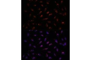 Immunofluorescence analysis of U-2 OS cells using DNTTIP2 antibody (ABIN7266732) at dilution of 1:100. (DNTTIP2 antibody  (AA 1-300))