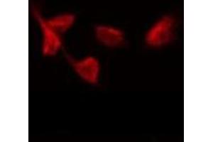 ABIN6275663 staining Hela by IF/ICC. (UBAP2L antibody  (Internal Region))