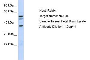 Host: Rabbit Target Name: NOC4L Sample Type: Fetal Brain lysates Antibody Dilution: 1. (NOC4L antibody  (N-Term))