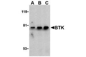 Image no. 2 for anti-Bruton Agammaglobulinemia tyrosine Kinase (BTK) (N-Term) antibody (ABIN206839) (BTK antibody  (N-Term))