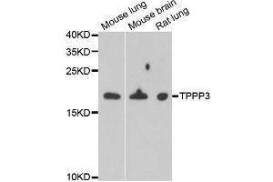 Western blot analysis of extracts of various cell lines, using TPPP3 antibody.