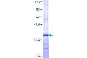 SLC27A5 Protein (AA 90-175) (GST tag)