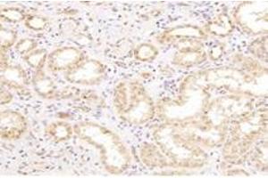 Immunohistochemistry (Paraffin-embedded Sections) (IHC (p)) image for anti-Cathepsin L2 (CTSL2) antibody (ABIN7073348)