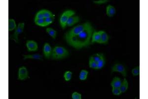 Immunofluorescence staining of MCF-7 cells with ABIN7149098 at 1:66, counter-stained with DAPI. (CYBA antibody  (AA 128-195))