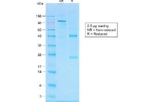 SDS-PAGE Analysis of Purified CD20 Rabbit Recombinant Monoclonal Antibody (IGEL/1497R).