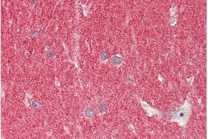 ABIN1049516 (5µg/ml) staining of paraffin embedded Human Cerebellum. (SNCA antibody  (Internal Region))