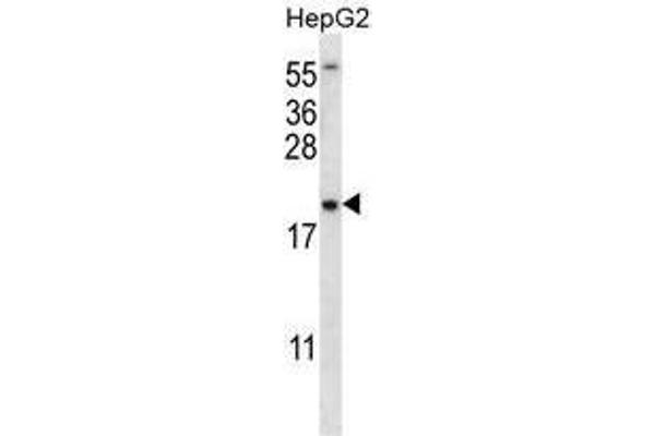 UBE2NL antibody  (N-Term)